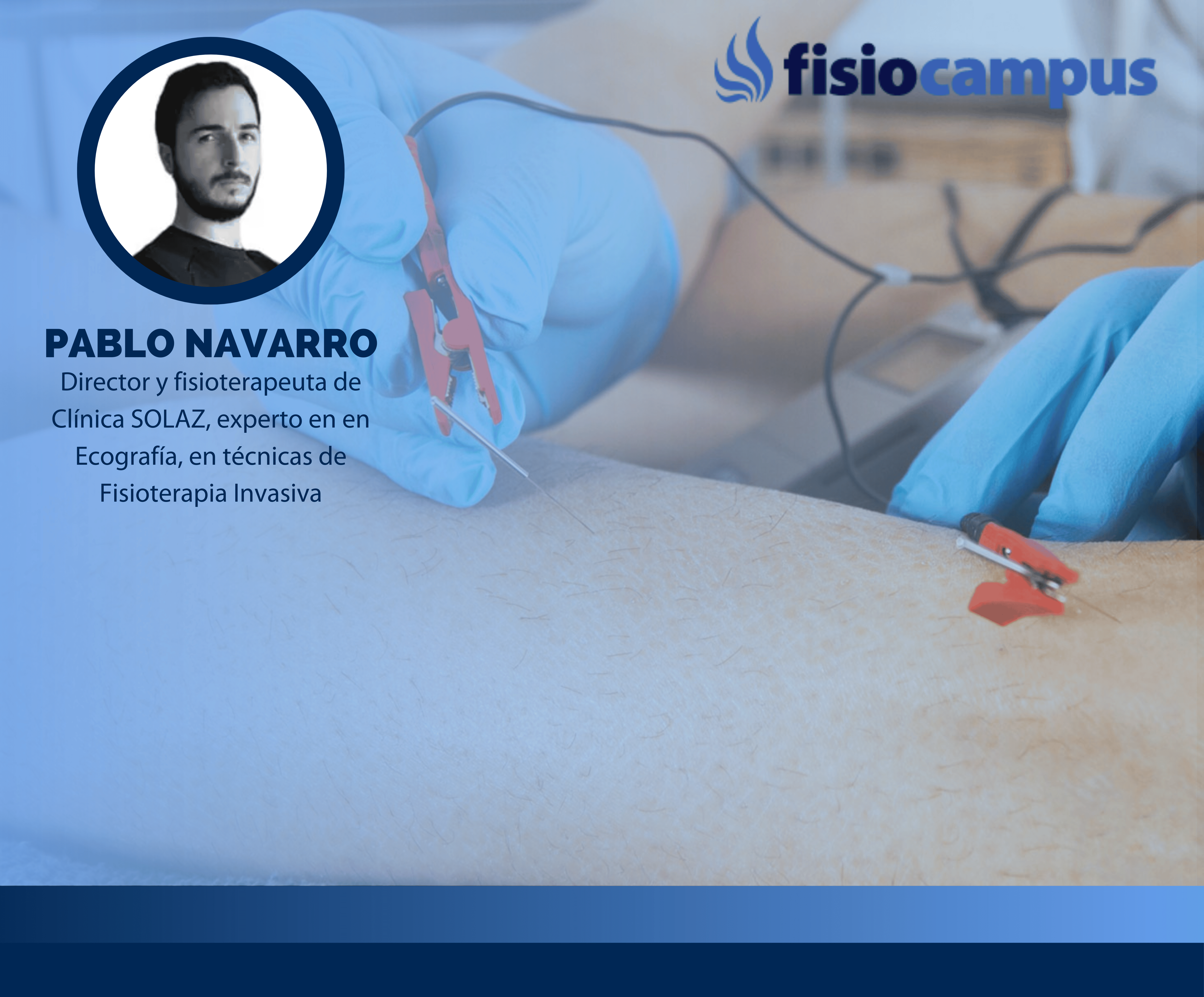 Neuromodulación Percutánea para fisioterapeutas