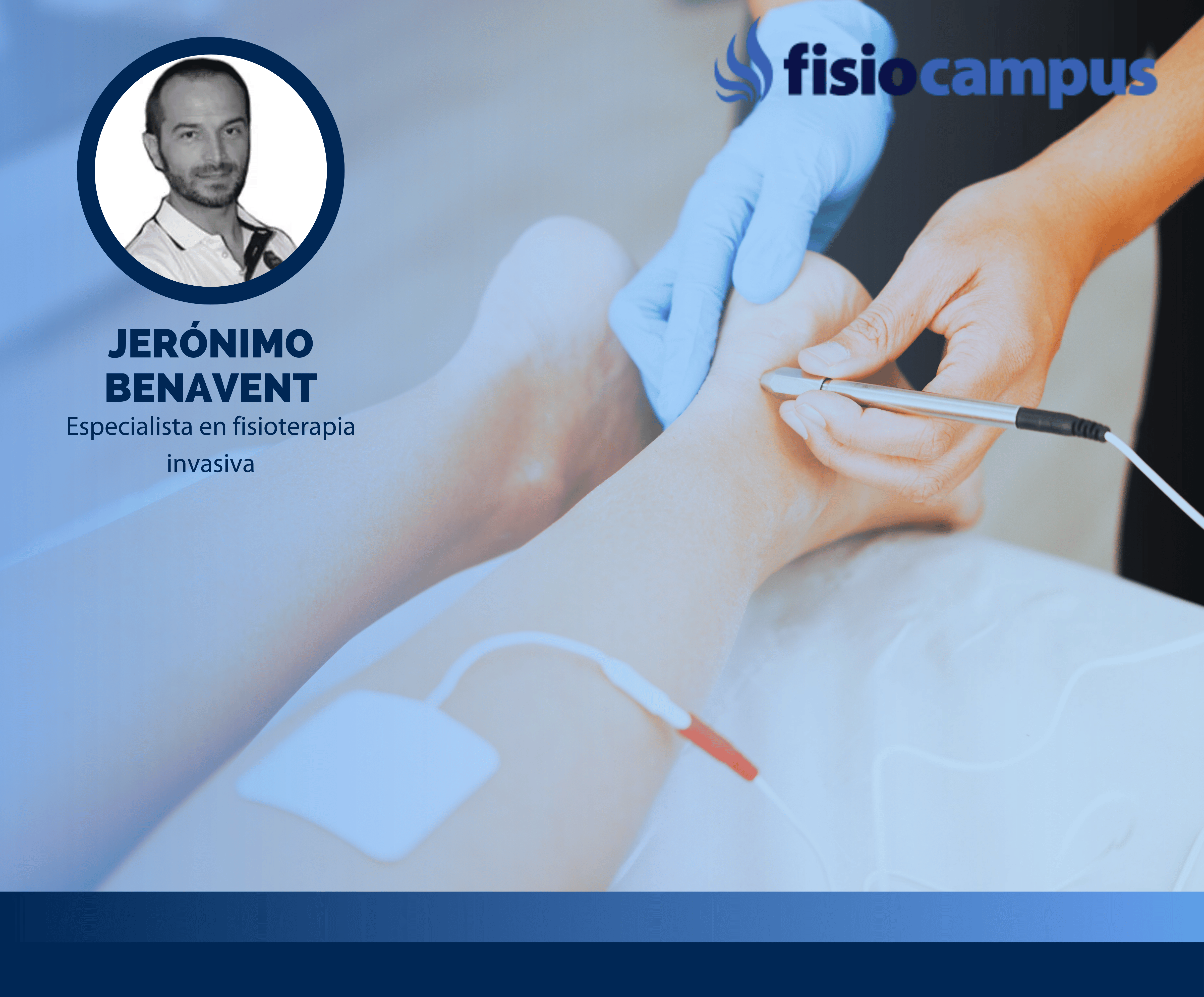 Abordaje invasivo de alteraciones neuromusculoesqueléticas de pie y tobillo - Diagnóstico y tratamiento