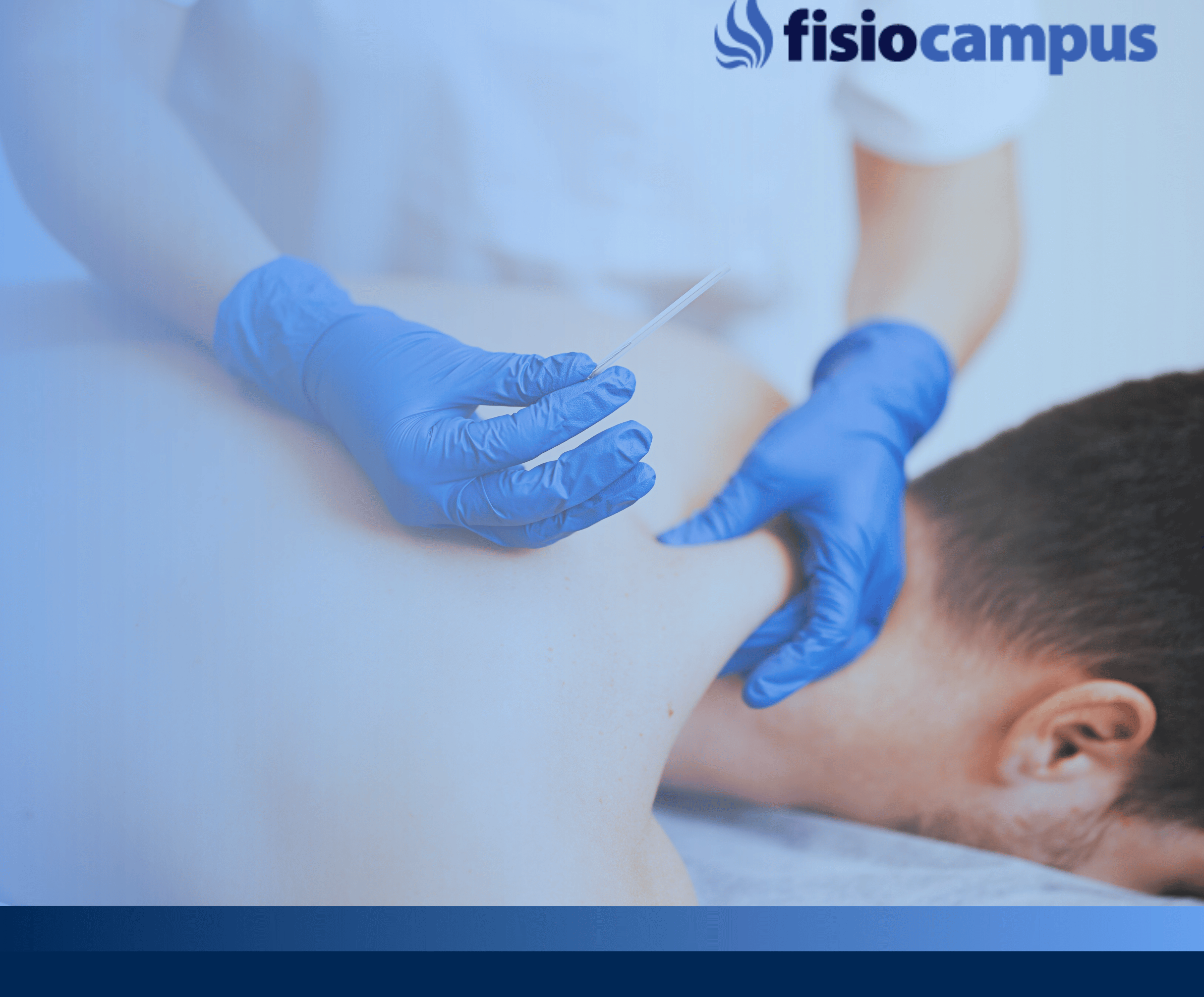 Punción Seca – Bases, fundamentos y aplicación practica