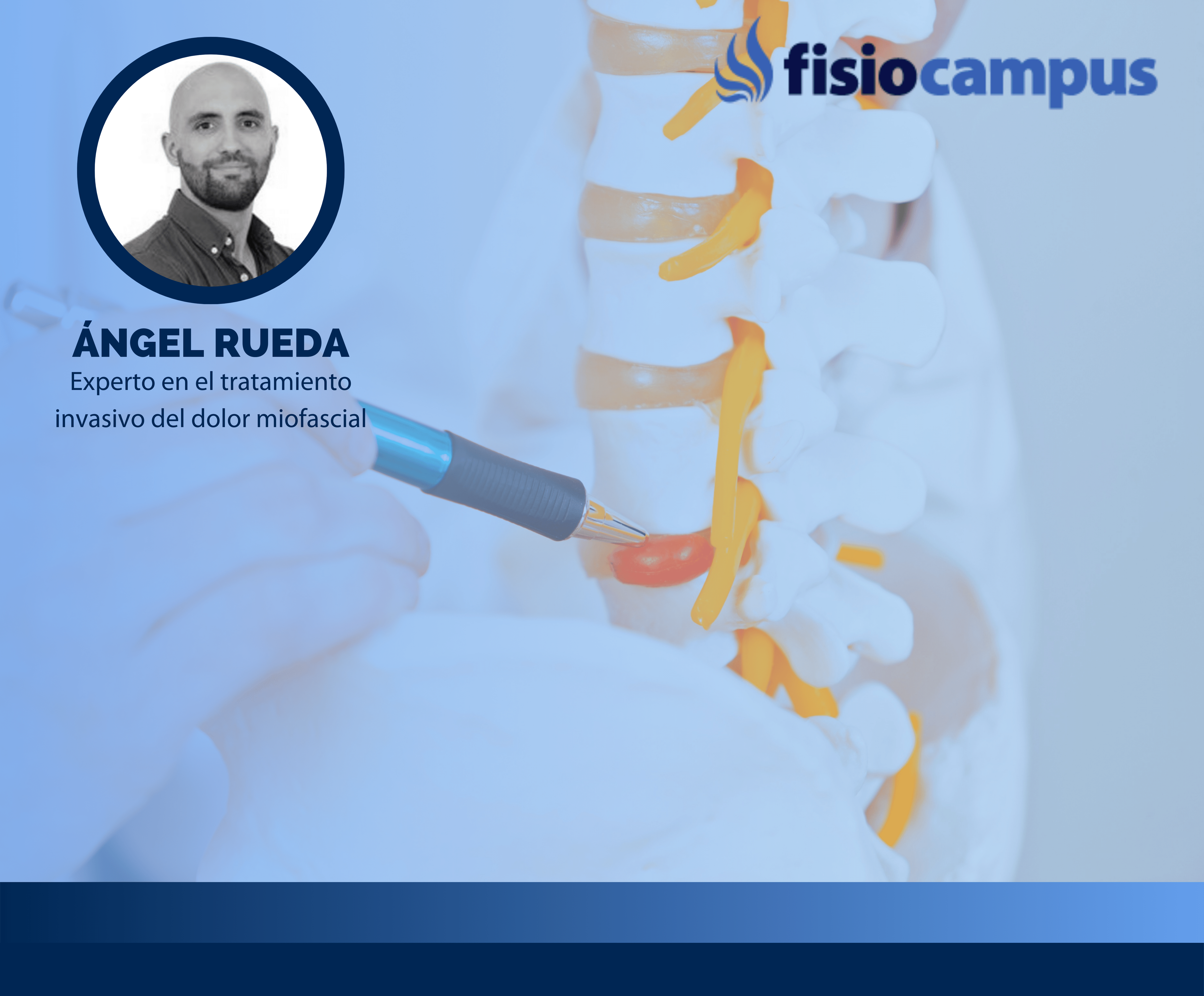 Aproximación a los síndromes radiculares de origen lumbar