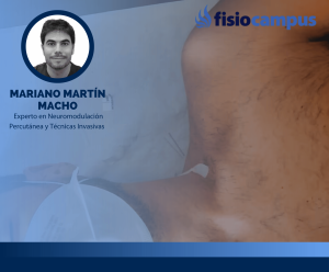 Abordaje invasivo en cervicobraquialgia - Caso clínico real