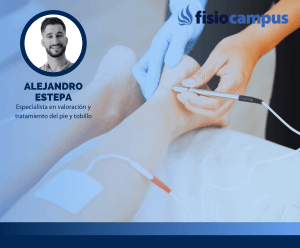 Neuromodulación transcutánea en alteraciones de pie