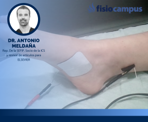 Estimulación del nervio tibial posterior: actualización y abordajes