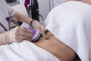 Comparativa de reducción en tejido graso abdominal con fisioterapia dermatofunci...