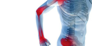 ¿Qué es el Síndrome de Dolor Miofascial? ¿Cómo puede tratarse?