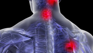 Síndrome doloroso miofascial y fibromialgia. Dos entidades diferentes con características similares.