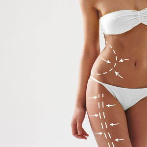 Importancia de la fisioterapia estética tras la liposicción