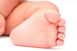 Astrágalo vertical congénito. ¿Tratamiento convencional?