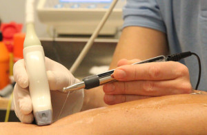 Utilización de la técnica de neuromodulación para el tratamiento del dolor lumba...