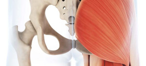 Participación del glúteo medio en el dolor lumbar crónico