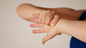 Síndrome del Túnel del Carpo, tratamiento conservador mediante movilización nerviosa periférica