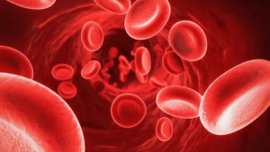 ¿Qué actividad física sería la ideal para pautar al paciente con Hemofilia?