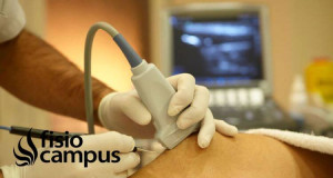 Electrólisis percutánea Intratisular (EPI) Qué es, indicaciones y contraindicaciones