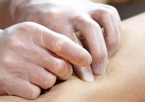 Efectos de la punción seca en el músculo gastrocnemio medial del paciente espástico