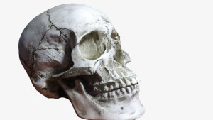 Cervicalgía y hombro. ¿Puede afectar el hombro a mi dolor cervical? Incluso, ¿Pu...