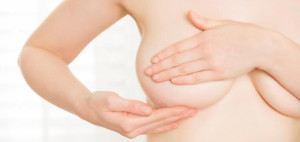 Ejercicio y linfedema en pacientes con cáncer