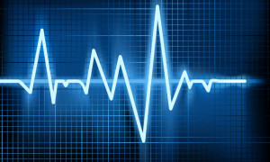 Variabilidad de la frecuencia cardíaca. Una manera de medir el estrés y la mejoría de nuestros pacientes. Parte II.