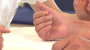 Enfermedad de Sudeck (Distofia simpático refleja) , ese gran desconocido