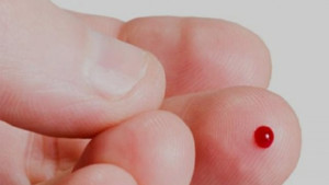 ¿Qué es la Hemofilia y qué papel juega la fisioterapia en este ámbito?